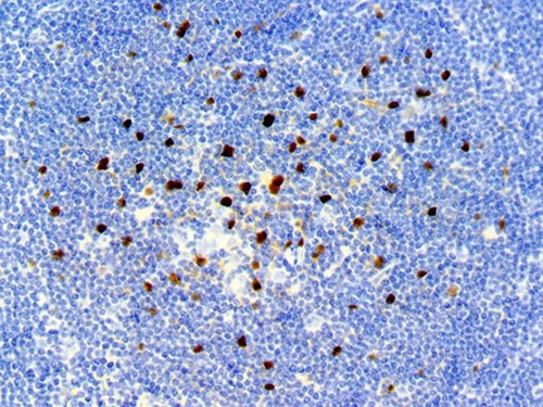 IHC of SOX-9 on an FFPE Lymph Node Tissue